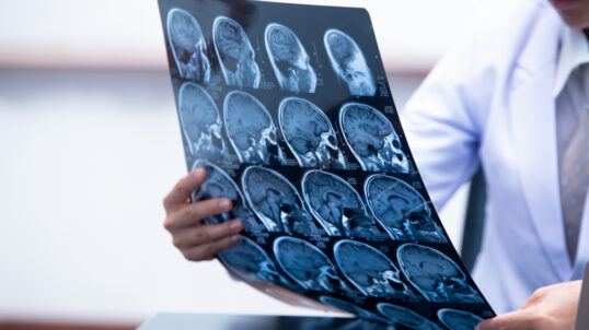 Teleradiology Services